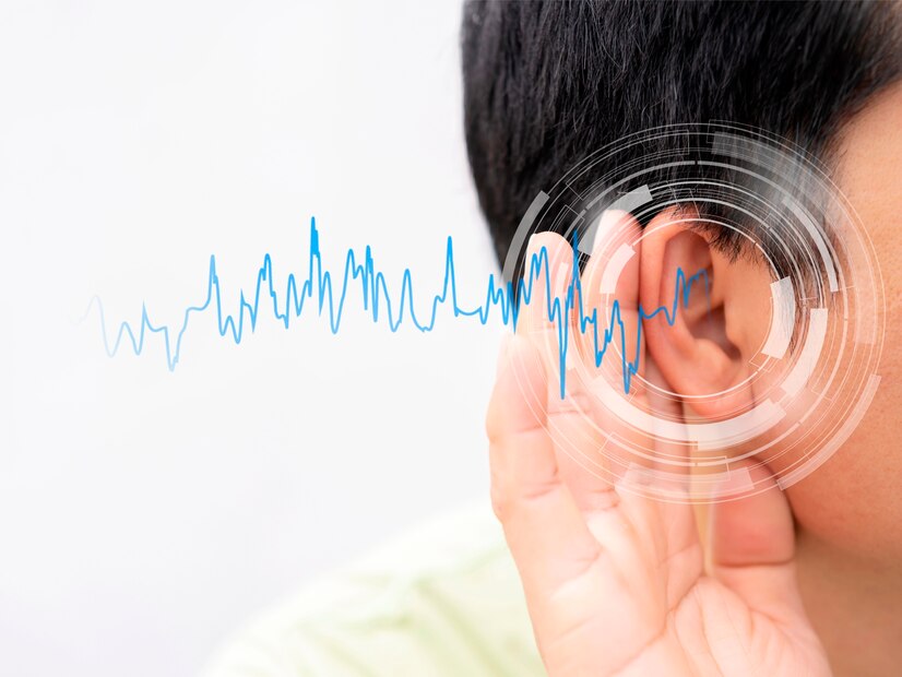 Internal Auditory Canal (IAC) and Cerebellopontine Angle (CPA): Comparison between T2-weighted SPACE and 3D-CISS sequences at 1.5T