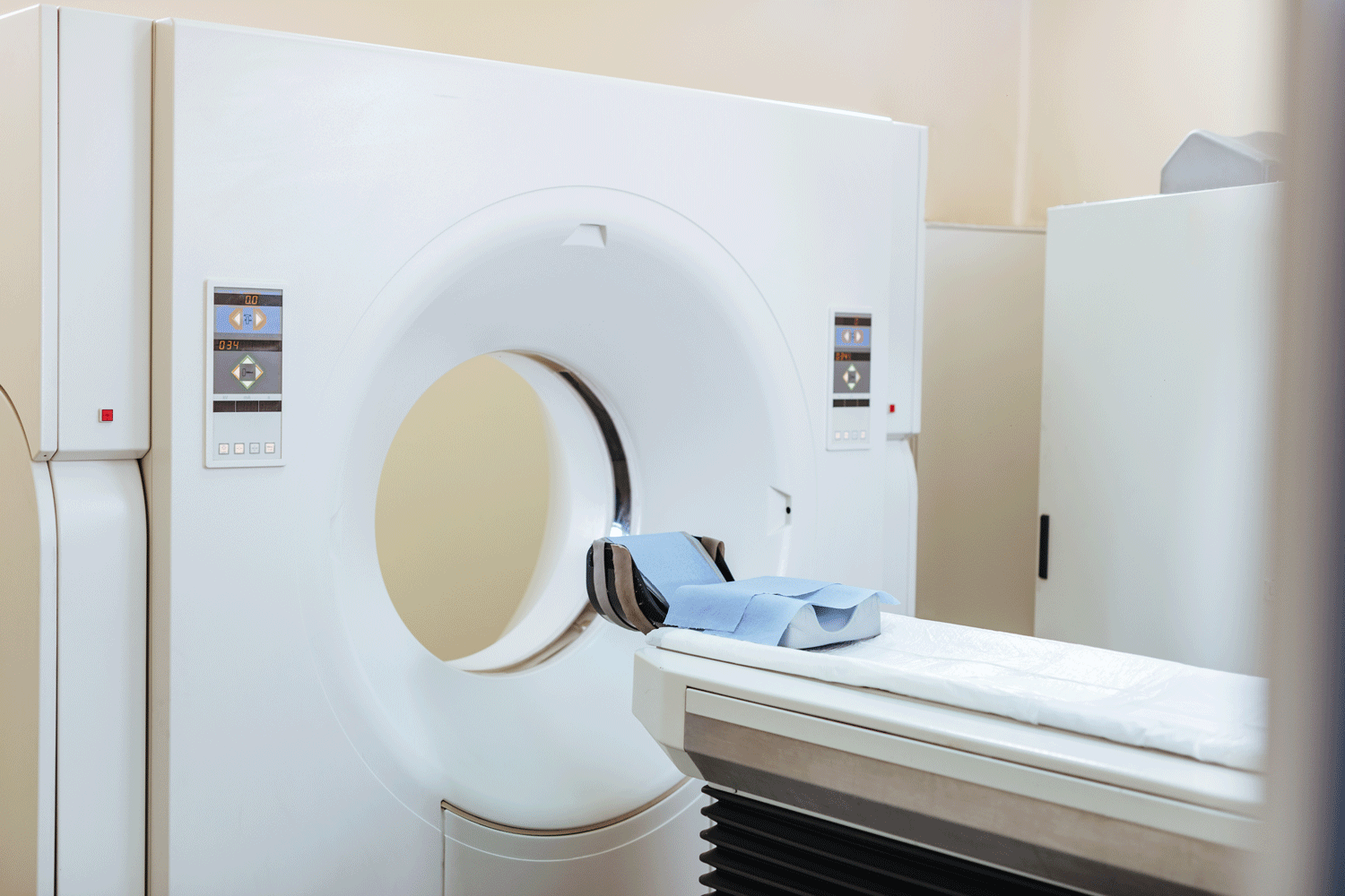 Statistical calculation of beta radiotherapy dose using I-131: analysis and simulation method